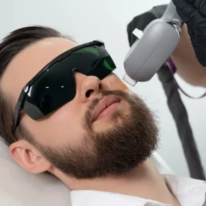 depilacion laser para hombres en Miraflores