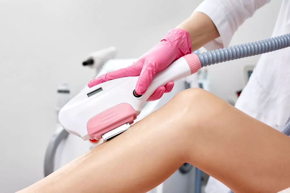 ¿Cómo prevenir la irritación en la piel con la depilación láser?