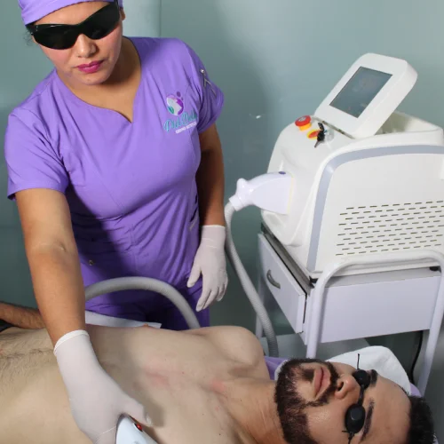 depilacion-laser-de-axilas-para-hombres-en-lima depilacion laser axilas